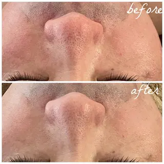 メンズ メナード岐阜茜部 杉浦のエステ・リラクイメージ