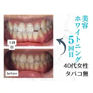 ホワイトニングサロン le  canonのその他イメージ