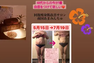 南国あまみんちゅ所属・矯正痩身サロン 南国あまみんちゅのエステ・リラクイメージ