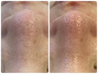 Hisui 小出のエステ・リラクイメージ