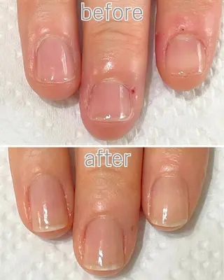 ネイル 自爪育成専門店 Kapilinaのネイルデザイン