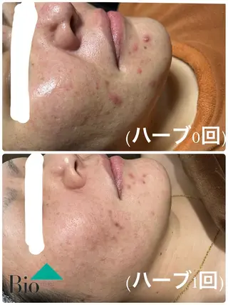 SALON BioBioのエステ・リラクイメージ