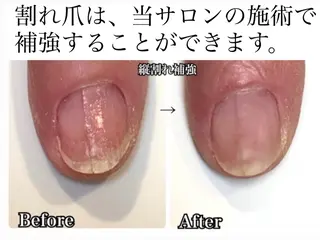 メンズ ネイル 深爪矯正専門店　ネイルサロン　トイロ所属・ネイルサロン トイロのネイルデザイン