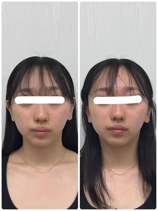 美容鍼×小顔矯正 ×美容整体　浜川泰仁のエステ・リラクイメージ