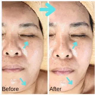 自然派フェイシャル やながわのエステ・リラクイメージ