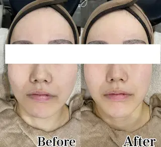 美肌サロンTIAM by tetoteのエステ・リラクイメージ