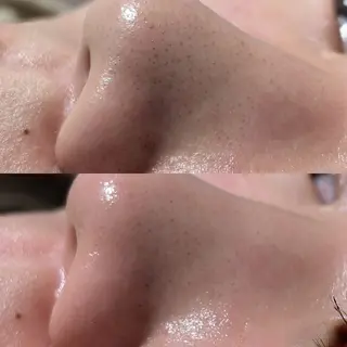 【Morphome】 ﾓﾙﾌｫﾑのエステ・リラクイメージ