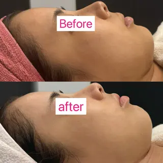 小顔/毛穴/ニキビ salon bealのエステ・リラクイメージ