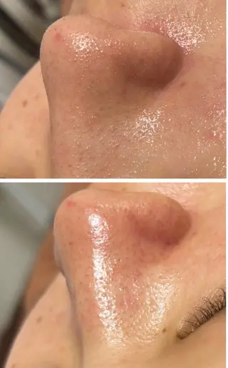 beauty  salon sorelle所属・産毛角質ケア/艶肌 フェイシャルワックスのエステ・リラクイメージ