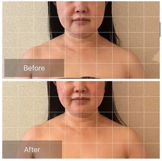 表情筋フェイシャル 三軒茶屋のエステ・リラクイメージ