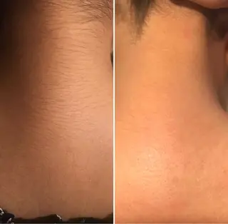 KoBa リンのマツエク・マツパデザイン