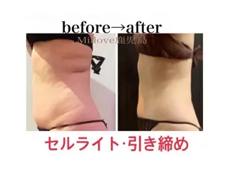 miilove 鹿児島店のエステ・リラクイメージ