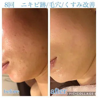 ミディアム カラー パーマ ヘアアレンジ メンズ ネイル マツエク・マツパ Ensor Clair所属・EnsorClair 代表 野口真央のエステ・リラクイメージ