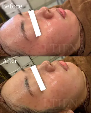 LTIENA新宿🌷 maiのエステ・リラクイメージ