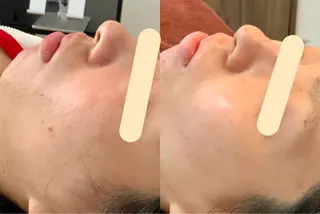 最速小顔・肌質管理 espoirマキのエステ・リラクイメージ