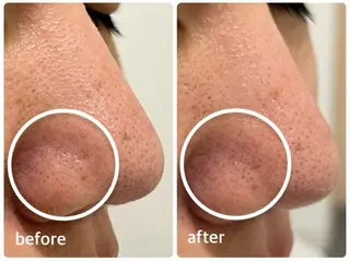 ナリス化粧品 Yumenaのエステ・リラクイメージ