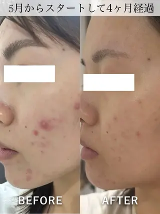 堀江リンパマッサージ 肩こり/リンパ/小顔のエステ・リラクイメージ