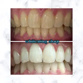 ホワイトニングショップ時津店所属・ホワイトニング ショップ長崎時津店のその他イメージ