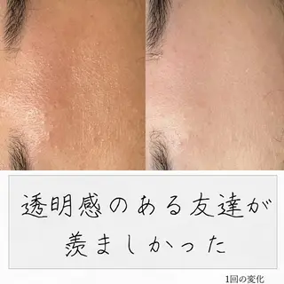 ニキビ経験者が施術 する専門サロン🌻のエステ・リラクイメージ