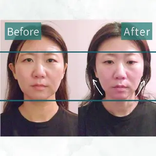 KANWA 鍼灸院のエステ・リラクイメージ