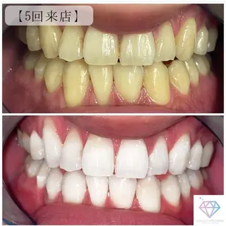 DIAMOND BEAUYのその他イメージ