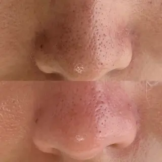 IRO KANAのマツエク・マツパデザイン