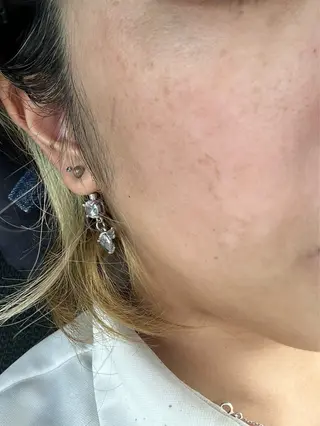 毛穴・肌質改善サロン ✨Tomaのその他イメージ