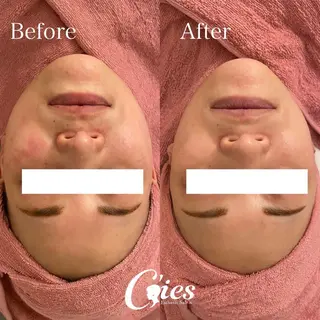 C'ies Esthetic Salon所属・CHIAKI ♪のエステ・リラクイメージ