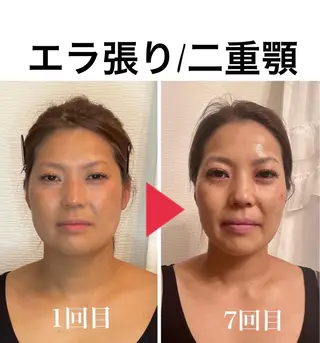 ミディアム カラー パーマ ヘアアレンジ ネイル マツエク・マツパ アイブロウ さくら夙川駅徒歩3分 最新韓国施術|脚やせのエステ・リラクイメージ