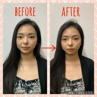 NO.10 整骨院のエステ・リラクイメージ