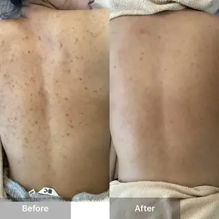 ハーブピーリング専門 MOKAのエステ・リラクイメージ