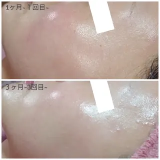 ワックスのお家サロン Rimmelのエステ・リラクイメージ