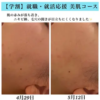 Bellesthe (ベルエステ)のエステ・リラクイメージ