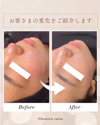 bonuru salonのエステ・リラクイメージ