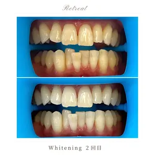 歯科医院提携 Retreatのエステ・リラクイメージ