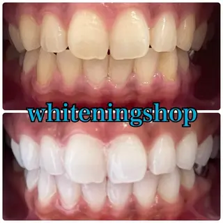 メンズ ホワイトニング専門店 10年の実績|樟葉駅のエステ・リラクイメージ