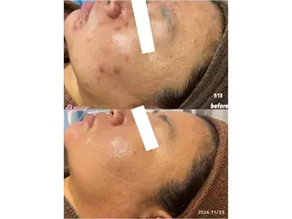 Fleur フルールのエステ・リラクイメージ