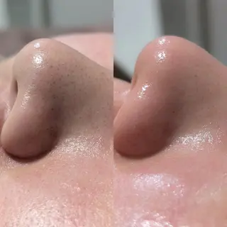 【Morphome】 ﾓﾙﾌｫﾑのエステ・リラクイメージ