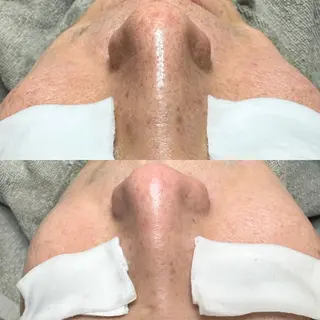 毛穴ケア特化専門店 トネア自由が丘店のエステ・リラクイメージ