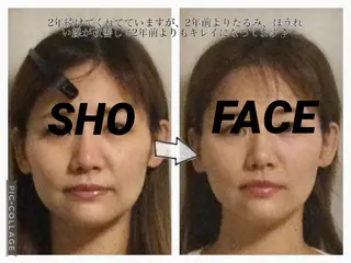 小顔矯正Sho  FaceDesignのエステ・リラクイメージ