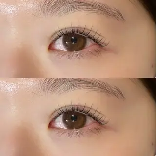 ใใใจใฏใปใใใ ๐๐๐๐๐ ๆ่ฑใฎใใใจใฏใปใใใใใถใคใณ
