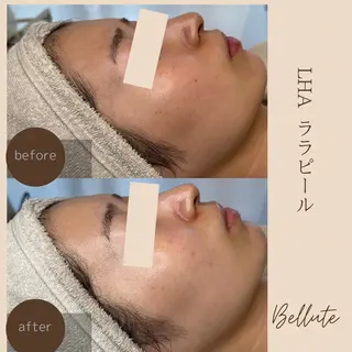 ピーリング専門店 Belluteのエステ・リラクイメージ
