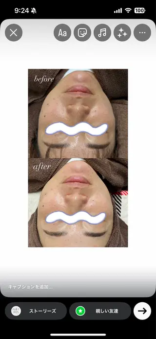 smileskin 京都/meguのその他イメージ