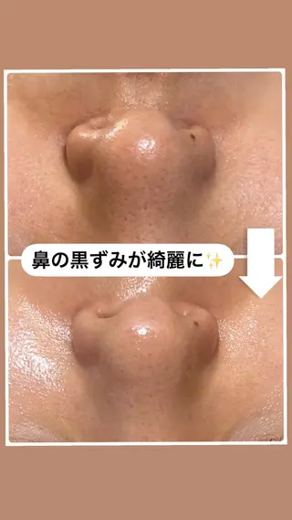 W MISATOのエステ・リラクイメージ