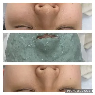 デ・アイム　柏所属・脱毛＆美肌 おざわまいのエステ・リラクイメージ