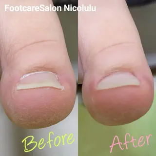 足トラブル専門 ニコルル金沢のエステ・リラクイメージ