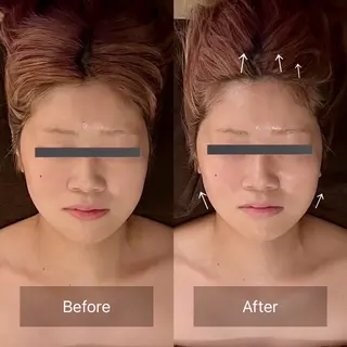 kogao&head Linoasのエステ・リラクイメージ