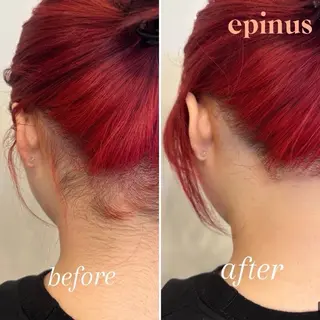 エピナス町田店 ブラジリアンワックスのエステ・リラクイメージ