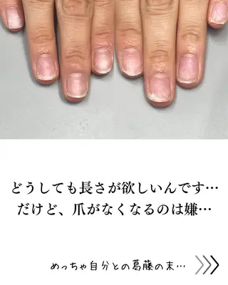 ネイル Aim* 深爪自爪育成専門店のネイルデザイン