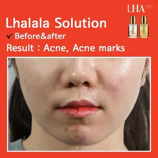 韓国式肌改善 ナスサロ/RuRuのエステ・リラクイメージ